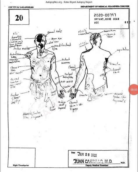 kobe bryant body sketch|A top LA County coroner described in graphic testimony what。